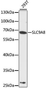 SLC9A8 Antibody in Western Blot (WB)