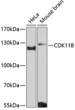 CDK11B Antibody in Western Blot (WB)