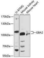 GBA2 Antibody in Western Blot (WB)