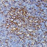 HLA-B Antibody in Immunohistochemistry (Paraffin) (IHC (P))