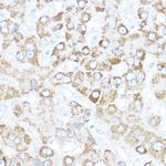 Kaiso Antibody in Immunohistochemistry (Paraffin) (IHC (P))