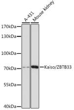 Kaiso Antibody in Western Blot (WB)