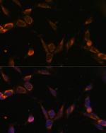 USP30 Antibody in Immunocytochemistry (ICC/IF)