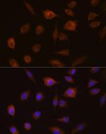 GSTT1 Antibody in Immunocytochemistry (ICC/IF)