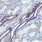 GSTT1 Antibody in Immunohistochemistry (Paraffin) (IHC (P))