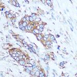 GSTT1 Antibody in Immunohistochemistry (Paraffin) (IHC (P))