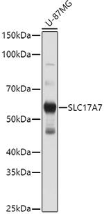 VGLUT1 Antibody in Western Blot (WB)