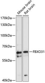 FBXO31 Antibody in Western Blot (WB)