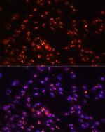 DKC1 Antibody in Immunocytochemistry (ICC/IF)