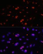 DKC1 Antibody in Immunocytochemistry (ICC/IF)