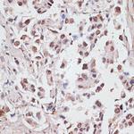 DKC1 Antibody in Immunohistochemistry (Paraffin) (IHC (P))