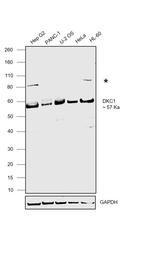 DKC1 Antibody in Western Blot (WB)