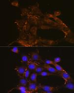 Fibronectin Antibody in Immunocytochemistry (ICC/IF)