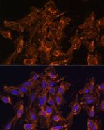 HSD17B8 Antibody in Immunocytochemistry (ICC/IF)