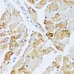 WSB2 Antibody in Immunohistochemistry (Paraffin) (IHC (P))