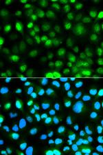 Ataxin 3 Antibody in Immunocytochemistry (ICC/IF)