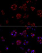 CD154 (CD40 Ligand) Antibody in Immunocytochemistry (ICC/IF)