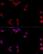 CD154 (CD40 Ligand) Antibody in Immunocytochemistry (ICC/IF)