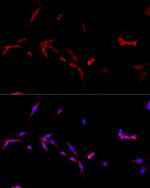 CD154 (CD40 Ligand) Antibody in Immunocytochemistry (ICC/IF)