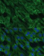 HAL Antibody in Immunocytochemistry (ICC/IF)