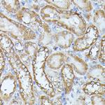 HAL Antibody in Immunohistochemistry (Paraffin) (IHC (P))