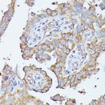 HAL Antibody in Immunohistochemistry (Paraffin) (IHC (P))