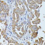 HAL Antibody in Immunohistochemistry (Paraffin) (IHC (P))