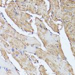 HAL Antibody in Immunohistochemistry (Paraffin) (IHC (P))