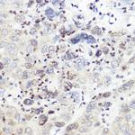 SREBP2 Antibody in Immunohistochemistry (Paraffin) (IHC (P))