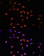 IFT88 Antibody in Immunocytochemistry (ICC/IF)