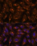 IFITM3 Antibody in Immunocytochemistry (ICC/IF)