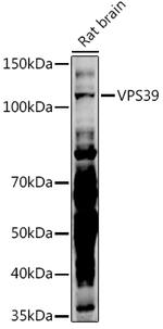 VPS39 Antibody in Western Blot (WB)