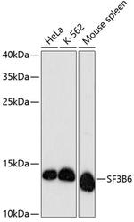 SF3B14 Antibody in Western Blot (WB)