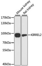 KIRREL2 Antibody in Western Blot (WB)