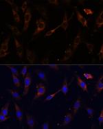 VPS25 Antibody in Immunocytochemistry (ICC/IF)