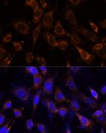 VPS25 Antibody in Immunocytochemistry (ICC/IF)