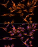 UNG Antibody in Immunocytochemistry (ICC/IF)