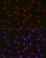 RBM14 Antibody in Immunocytochemistry (ICC/IF)