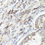 IL-1 alpha Antibody in Immunohistochemistry (Paraffin) (IHC (P))