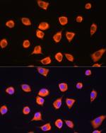 SCYL2 Antibody in Immunocytochemistry (ICC/IF)