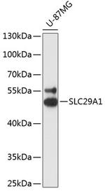 ENT1 Antibody in Western Blot (WB)