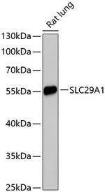 ENT1 Antibody in Western Blot (WB)