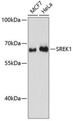 SFRS12 Antibody in Western Blot (WB)