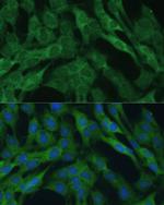 IDH1 Antibody in Immunocytochemistry (ICC/IF)