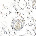 Podoplanin Antibody in Immunohistochemistry (Paraffin) (IHC (P))