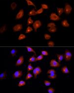 DBI Antibody in Immunocytochemistry (ICC/IF)