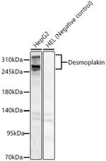 Desmoplakin Antibody in Western Blot (WB)