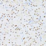 ETV1 Antibody in Immunohistochemistry (Paraffin) (IHC (P))