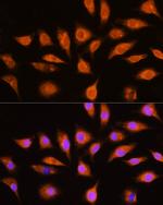 GNAI3 Antibody in Immunocytochemistry (ICC/IF)