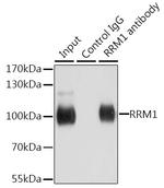 RRM1 Antibody in Immunoprecipitation (IP)